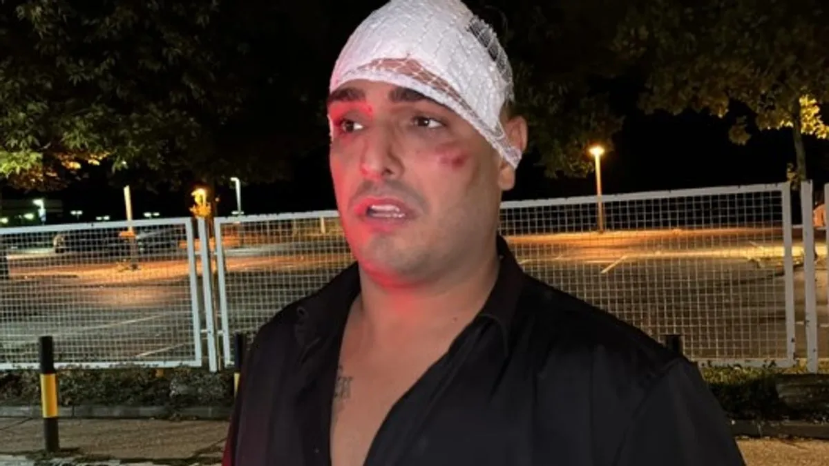 Pjevaču glava u zavoju, lice u posjekotinama: Evo kako izgleda mjesto nesreće