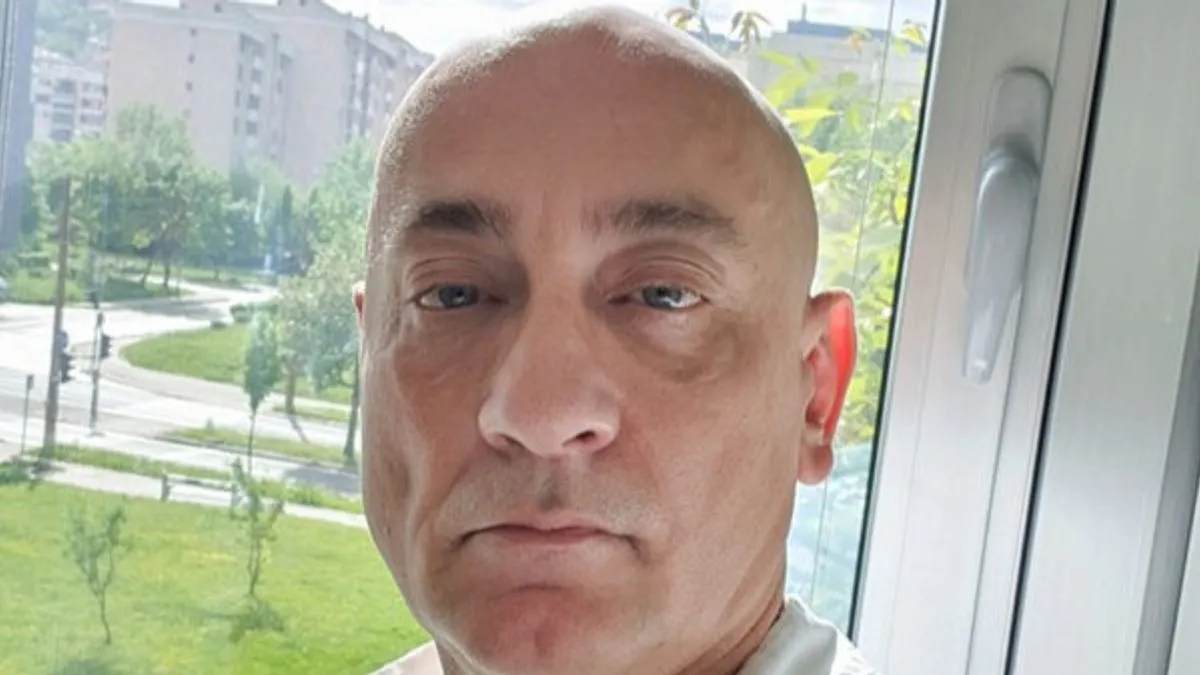 Mračna strana tretmana za ljepotu: Azri deformisano lice u nelicenciranoj ordinaciji