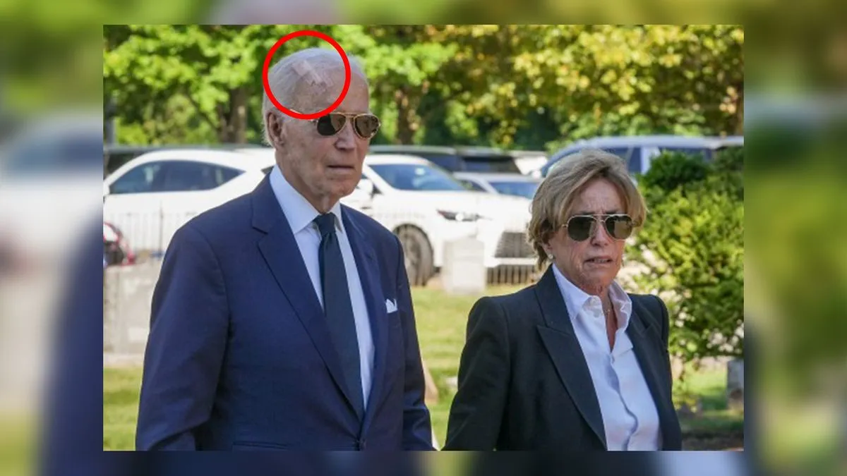 Šokantni snimak podijeljen na društvenim mrežama prikazuje Bidena s uočljivo crvenom ranom na prednjoj strani glave