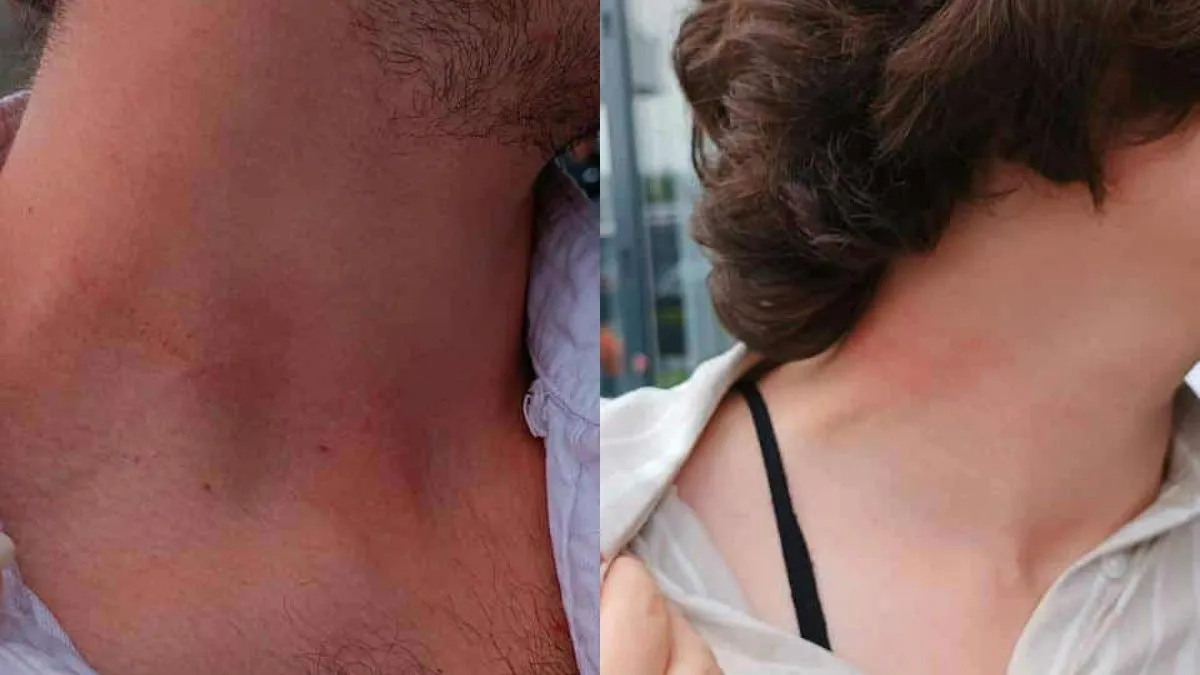 Modrice će proći, ali da li će se ljudskost ikada usaditi u one koji šute, podržavaju i učestvuju u genocidu...