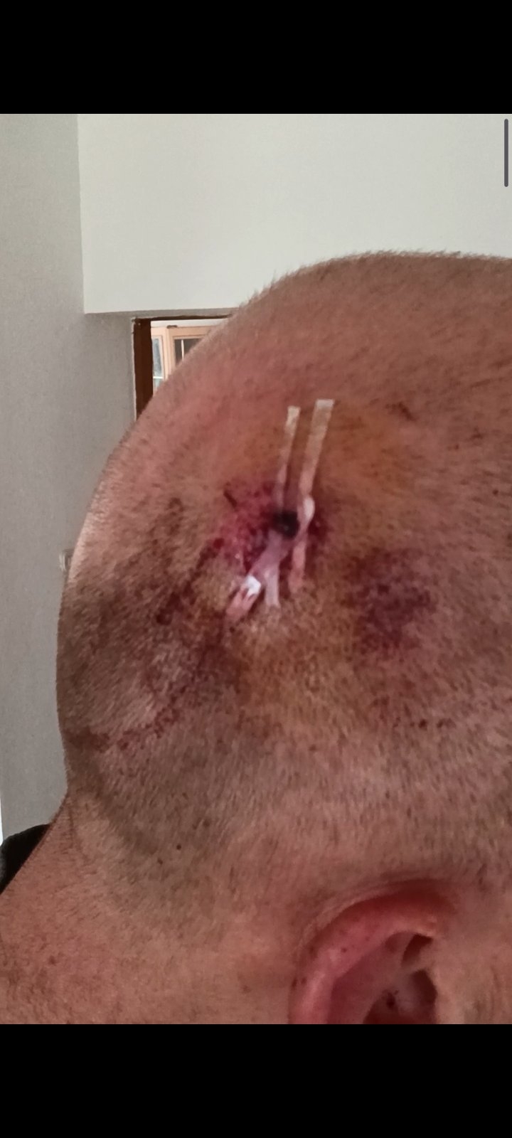 function r(){if(it(n),n.value===Hm){let o=null;throw new D(-950,o)}return n.value}