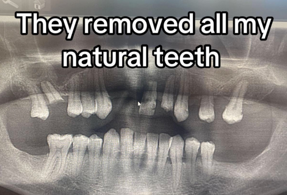 function r(){if(it(n),n.value===Hm){let o=null;throw new D(-950,o)}return n.value}