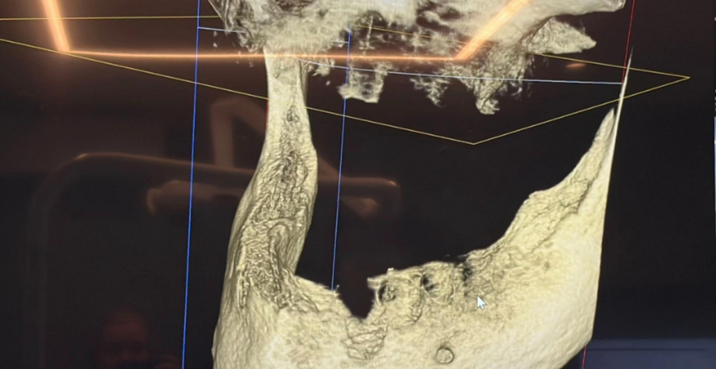 function r(){if(it(n),n.value===Hm){let o=null;throw new D(-950,o)}return n.value}