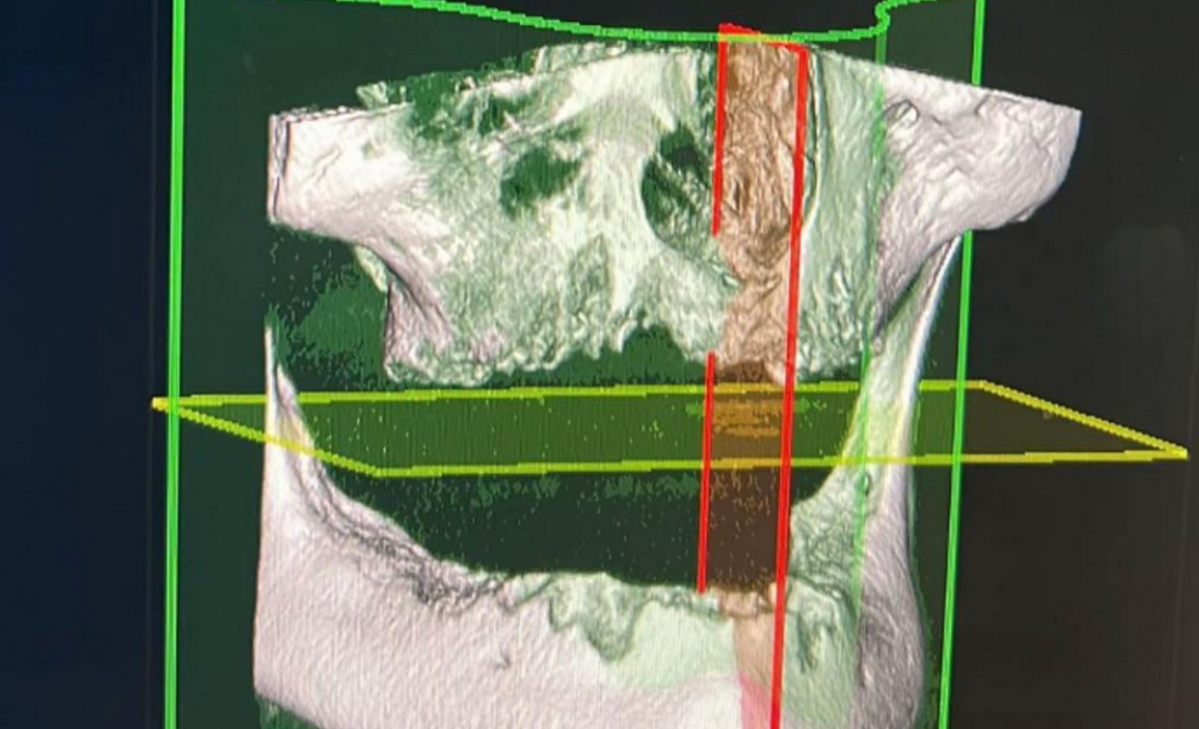 function r(){if(it(n),n.value===Hm){let o=null;throw new D(-950,o)}return n.value}