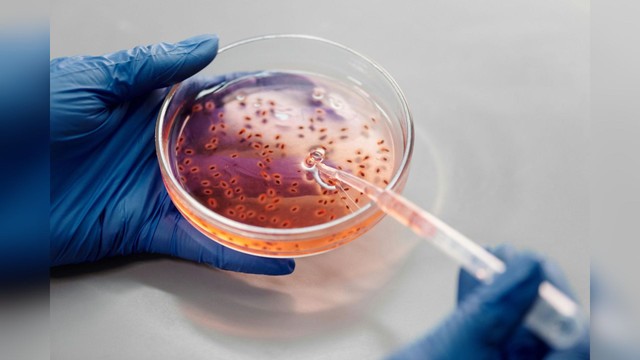 Hantavirus