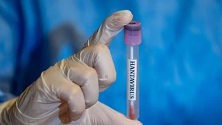 Hantavirus