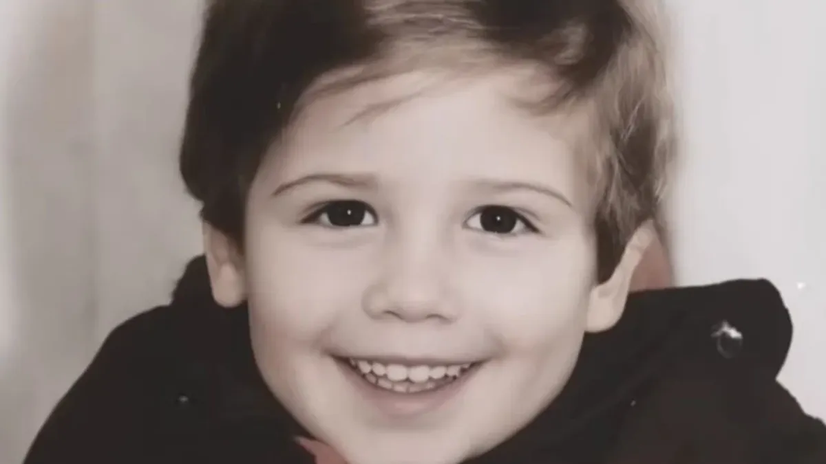 Alen ima specifičnu resicu desnog uha koja nije u potpunosti srasla i razlikuje se od lijeve za oko jedan centimetar. 